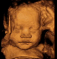 4d ultrasound houston