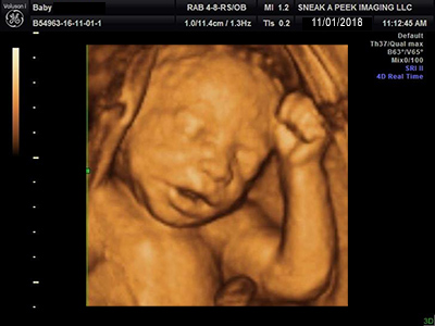 3d-4d-ultrasound-houston-texas | Sneak A Peek Imaging 3D4D ...