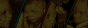4d ultrasound in houston tx