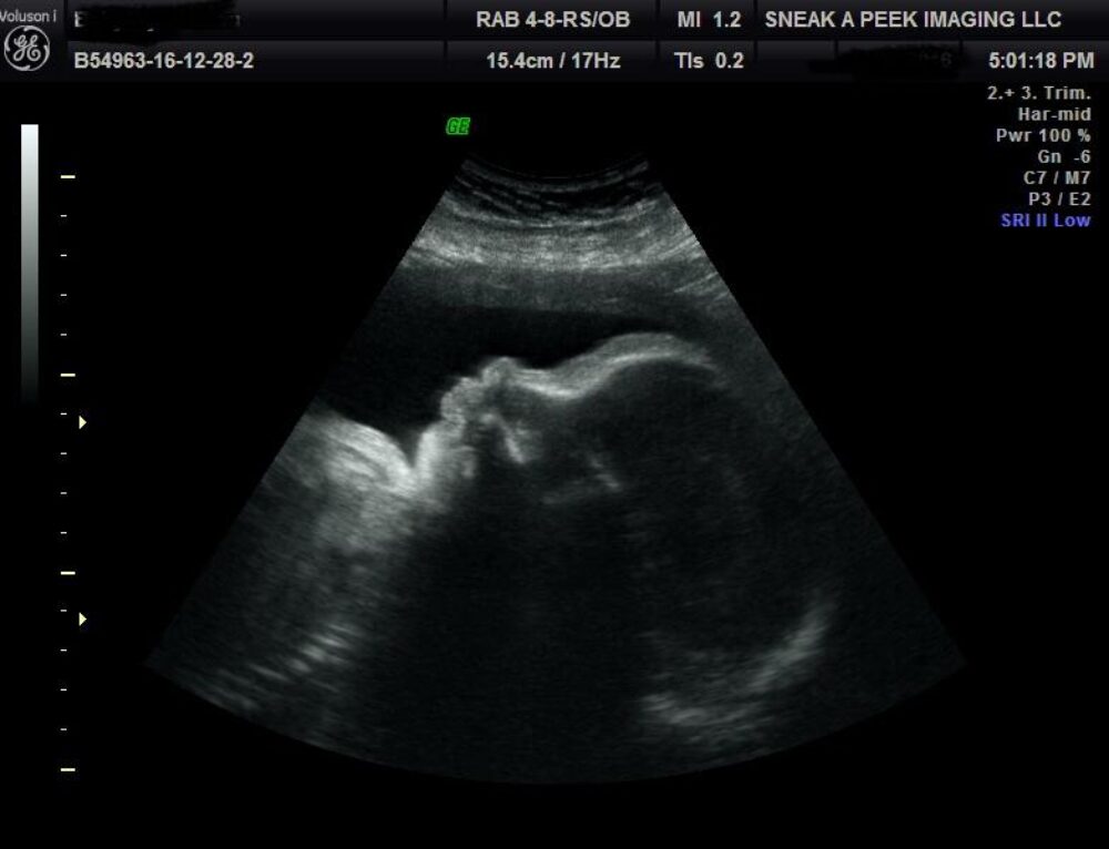 4D Ultrasound Houston Images, Benefits, Cost & Locations Near Me