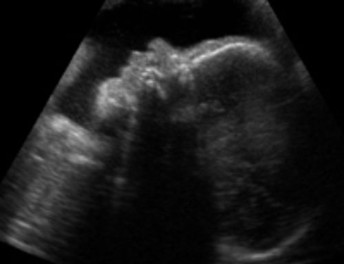 A Powerful Bonding Experience