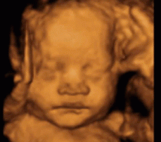 4d ultrasound houston
